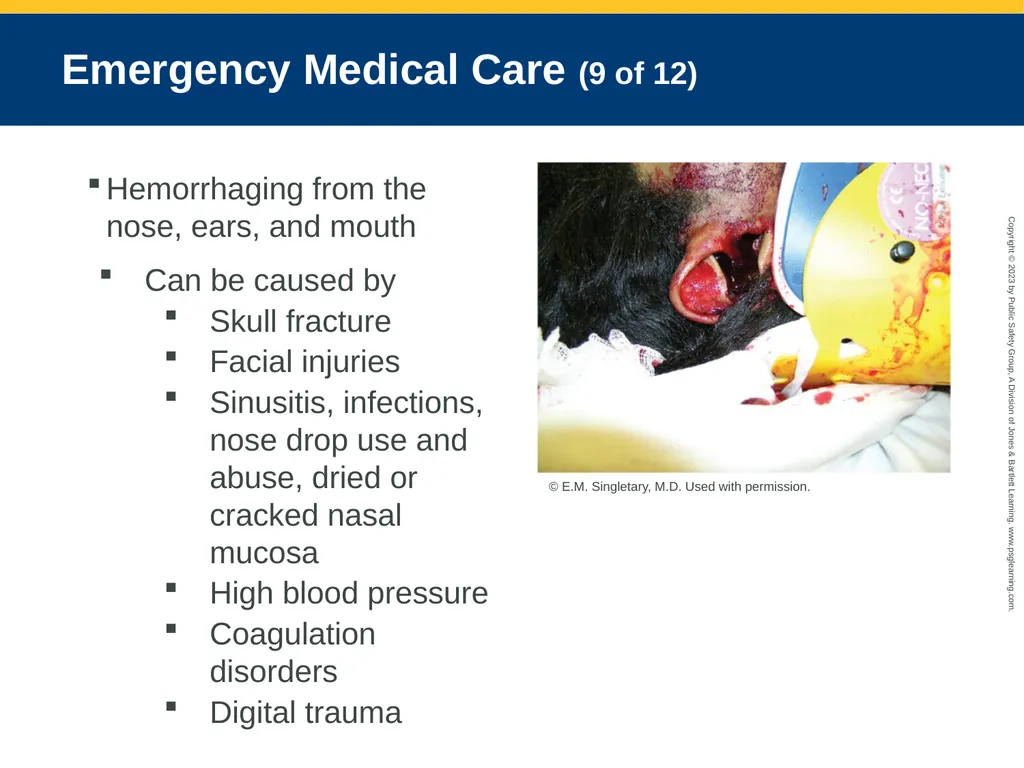 Bleeding CHAPTER 27: Focused Lecture National EMS - slide 31 of 34