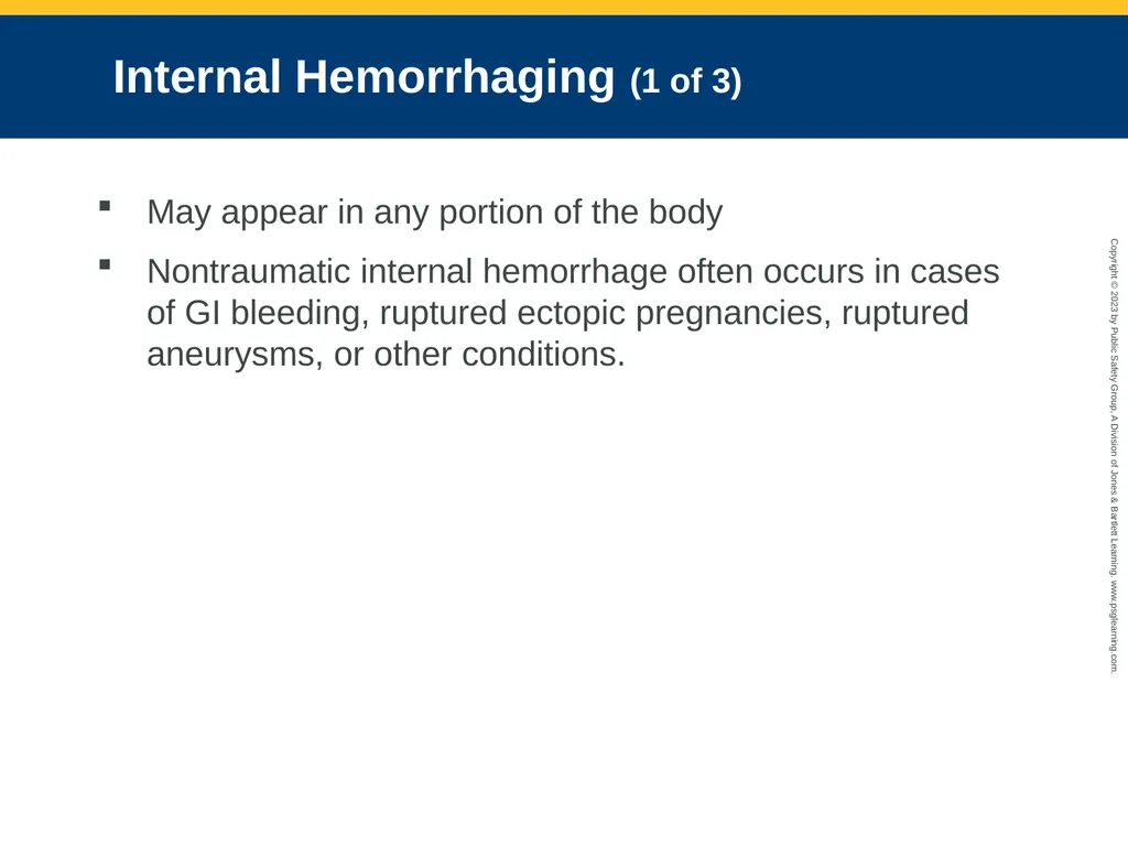 Bleeding CHAPTER 27: Focused Lecture National EMS - slide 12 of 34