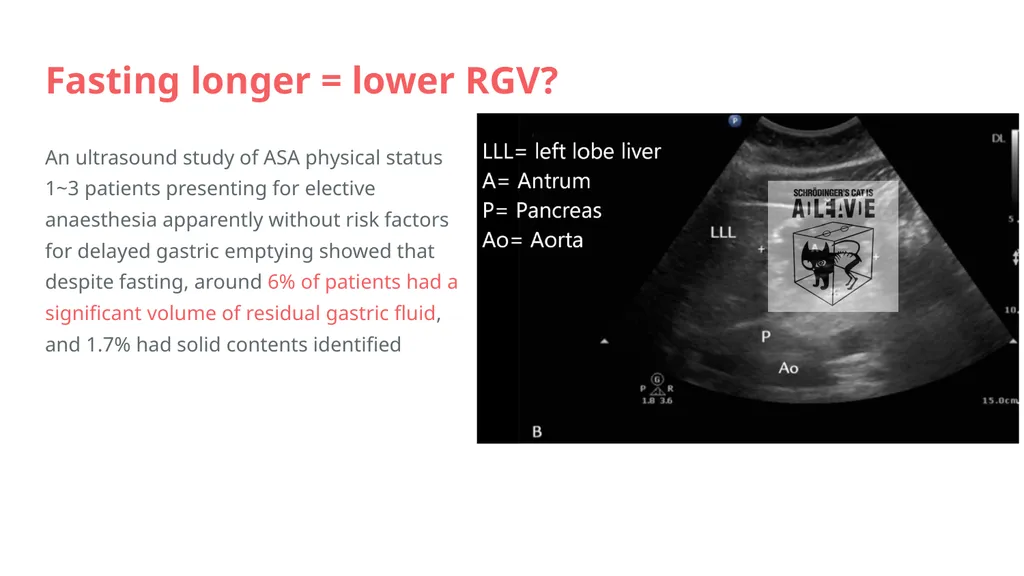 Preoperative Fasting Hannah Liu Topic For patients - slide 43 of 69