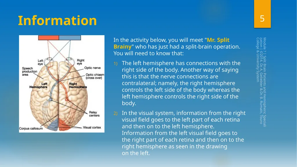 Split-Brain Patients and Hemispheric - slide 5 of 34