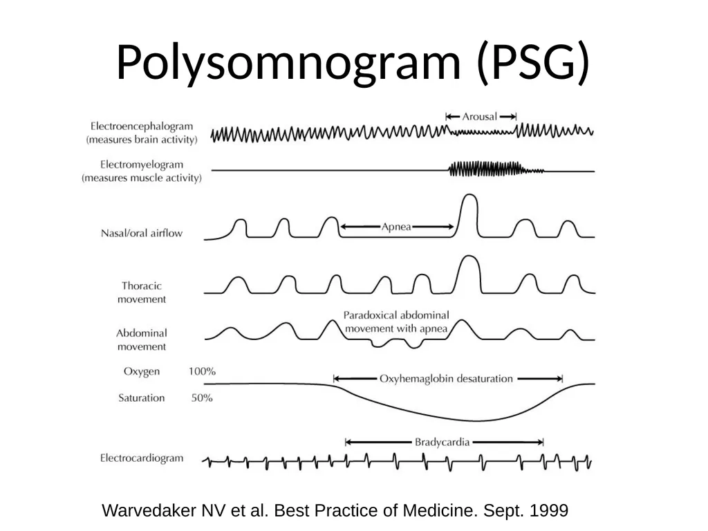 Interpreting Sleep Study Reports: A Primer for - slide 3 of 23