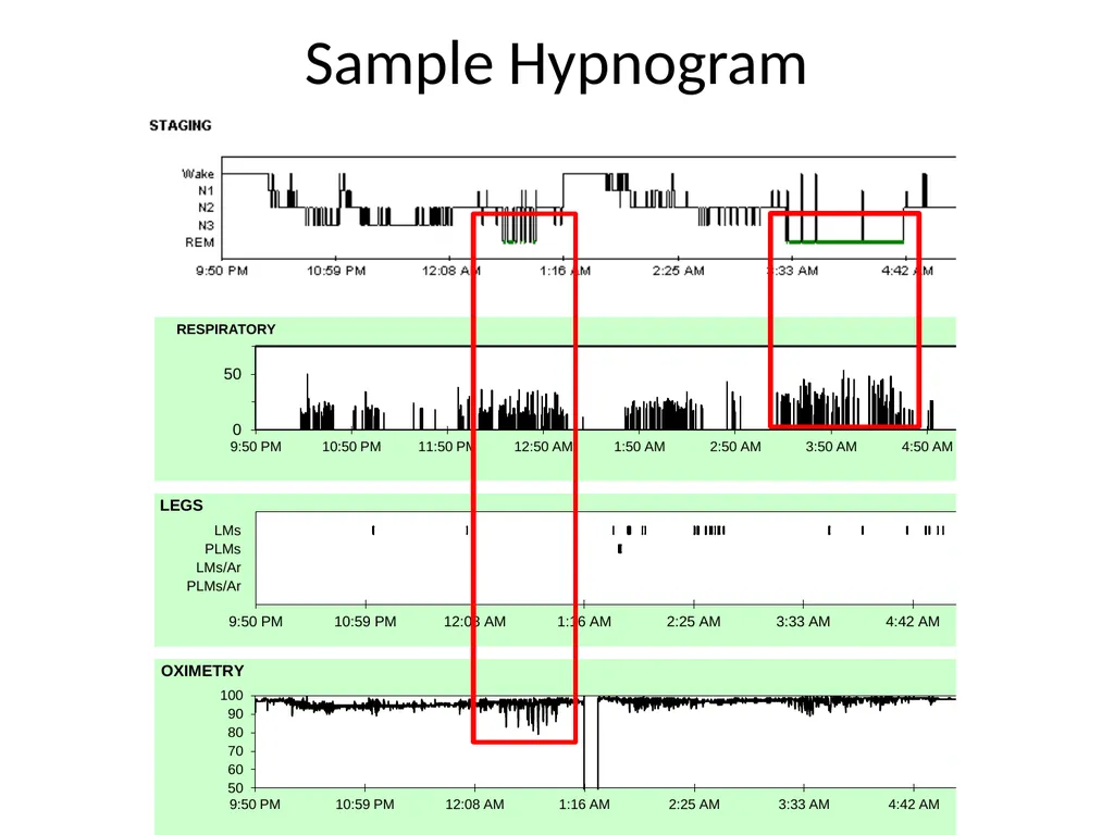 Interpreting Sleep Study Reports: A Primer for - slide 17 of 23