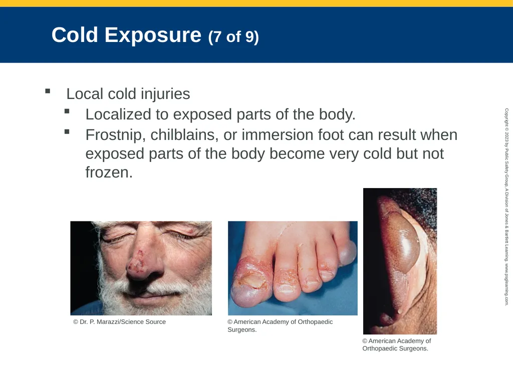 CHAPTER 34: Focused Lecture Environmental - slide 15 of 128