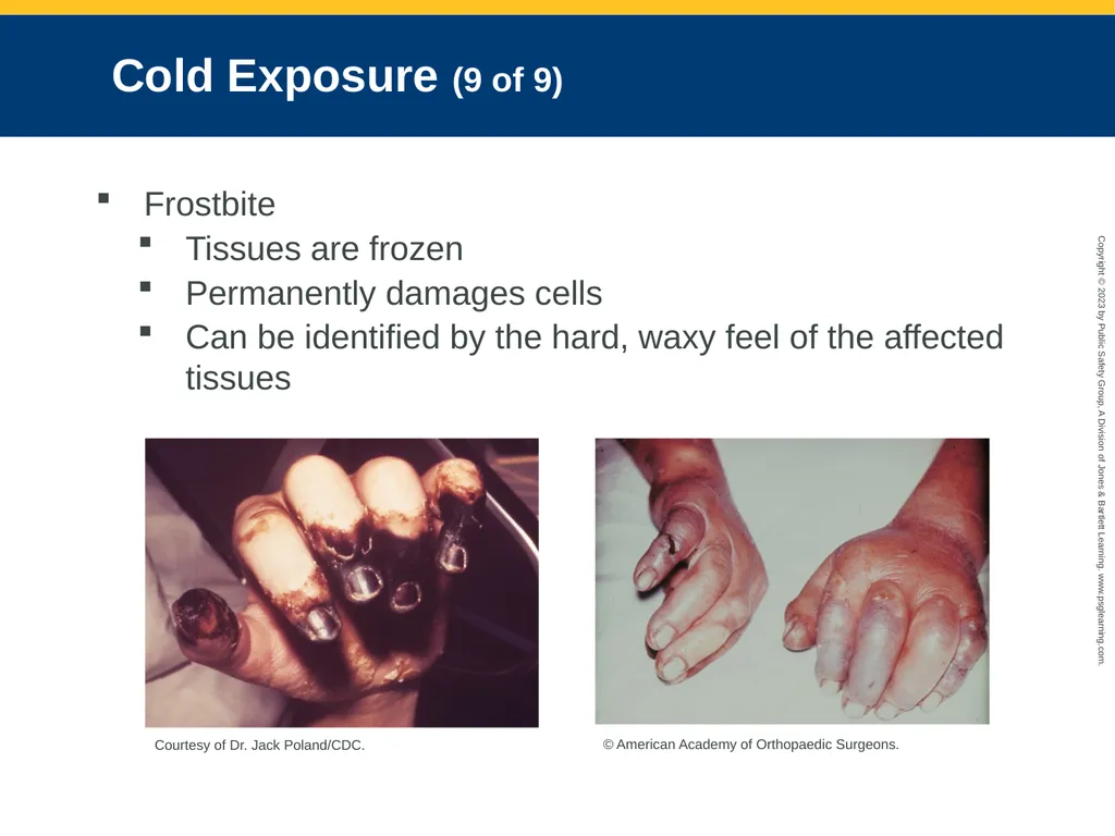 CHAPTER 34: Focused Lecture Environmental - slide 17 of 128