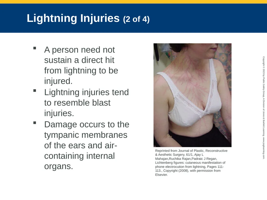 CHAPTER 34: Focused Lecture Environmental - slide 93 of 128