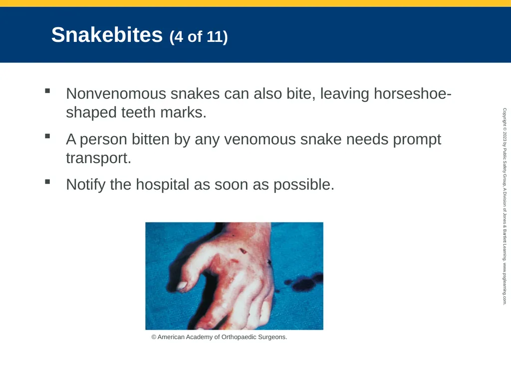 CHAPTER 34: Focused Lecture Environmental - slide 111 of 128