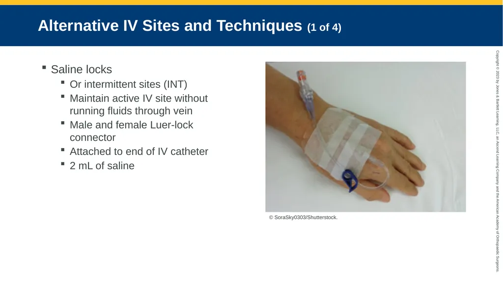 Medication Administration CHAPTER 14 Introduction - slide 55 of 185