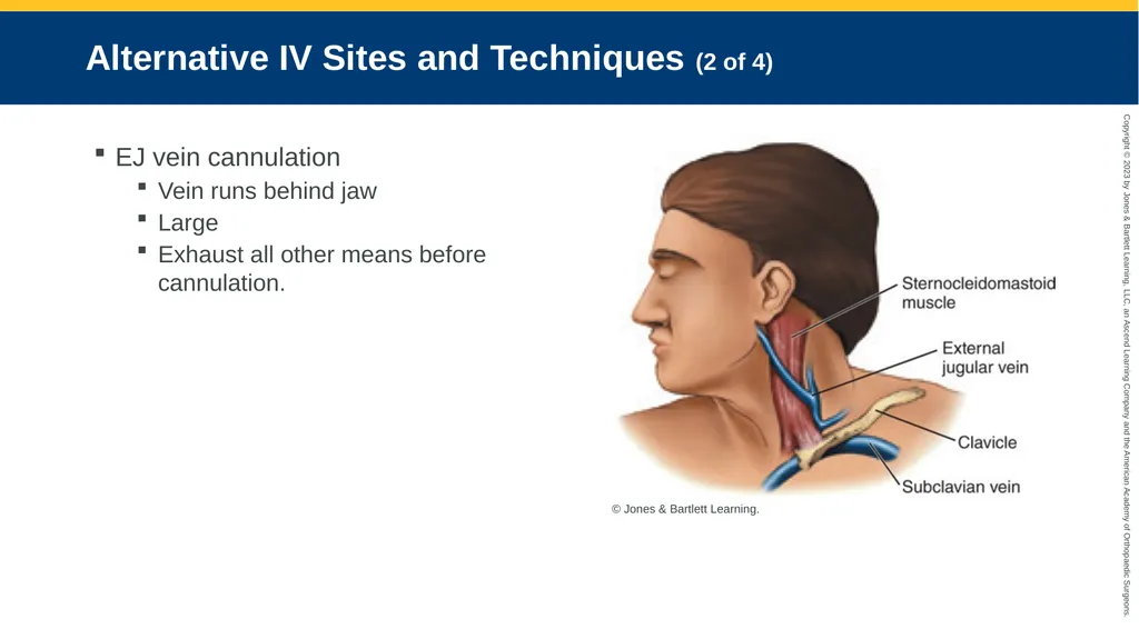 Medication Administration CHAPTER 14 Introduction - slide 56 of 185