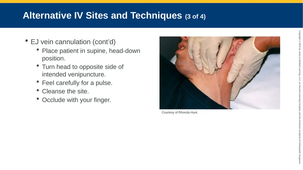 Medication Administration CHAPTER 14 Introduction - slide 57 of 185