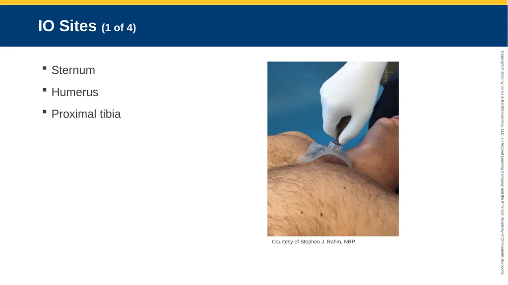 Medication Administration CHAPTER 14 Introduction - slide 96 of 185