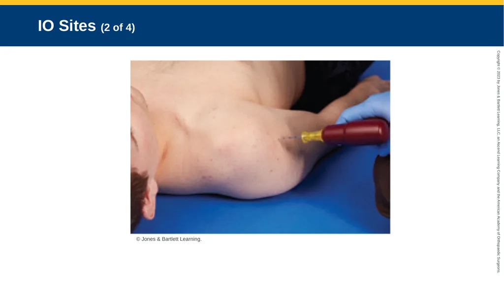 Medication Administration CHAPTER 14 Introduction - slide 97 of 185