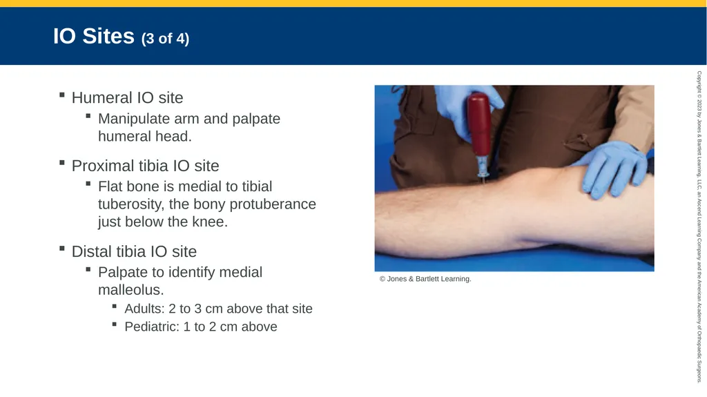 Medication Administration CHAPTER 14 Introduction - slide 98 of 185