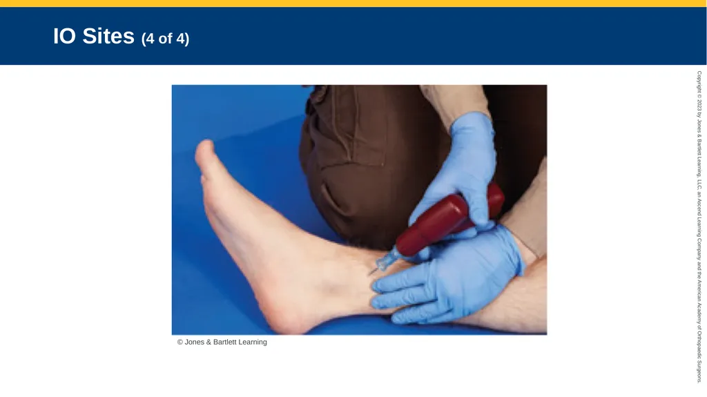 Medication Administration CHAPTER 14 Introduction - slide 99 of 185