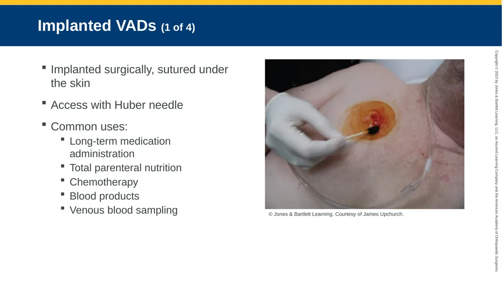 Medication Administration CHAPTER 14 Introduction - slide 181 of 185
