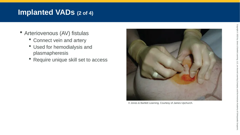 Medication Administration CHAPTER 14 Introduction - slide 182 of 185
