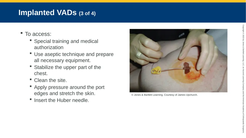 Medication Administration CHAPTER 14 Introduction - slide 183 of 185