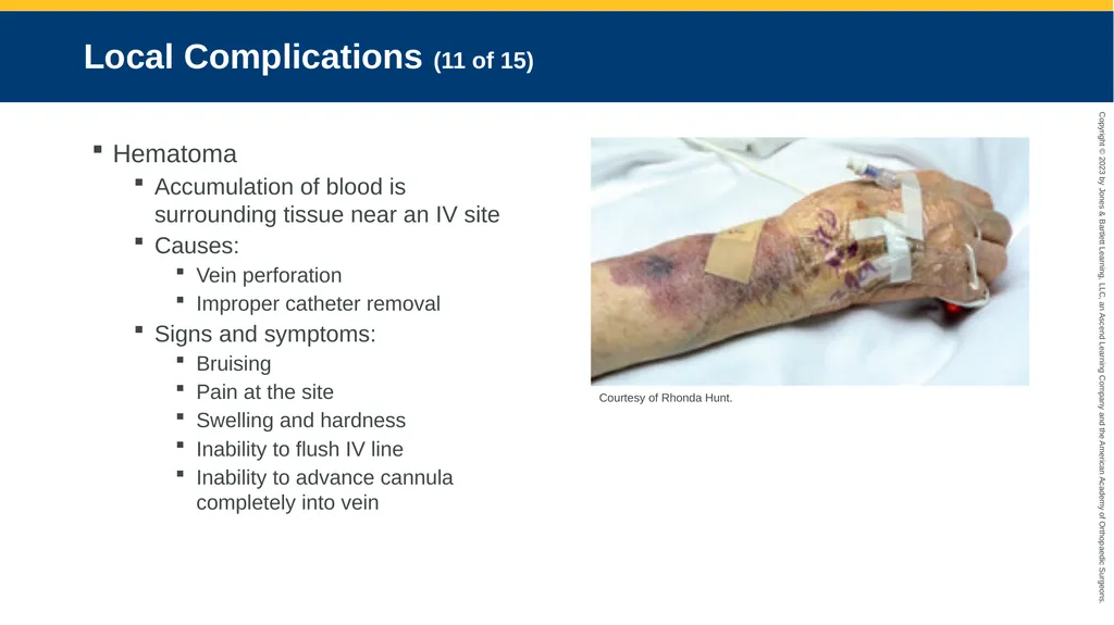 Medication Administration CHAPTER 14 Introduction - slide 74 of 185