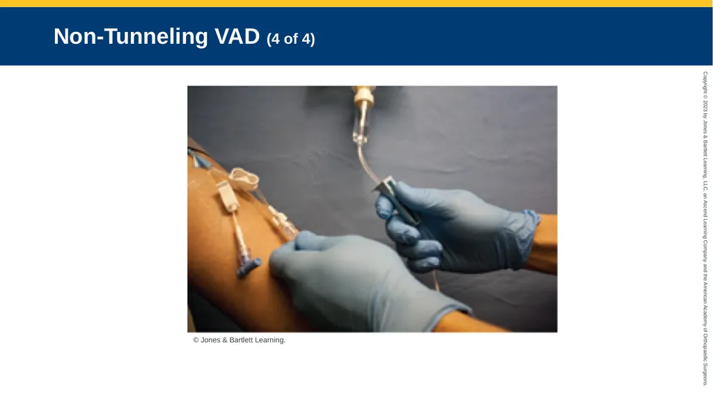 Medication Administration CHAPTER 14 Introduction - slide 180 of 185