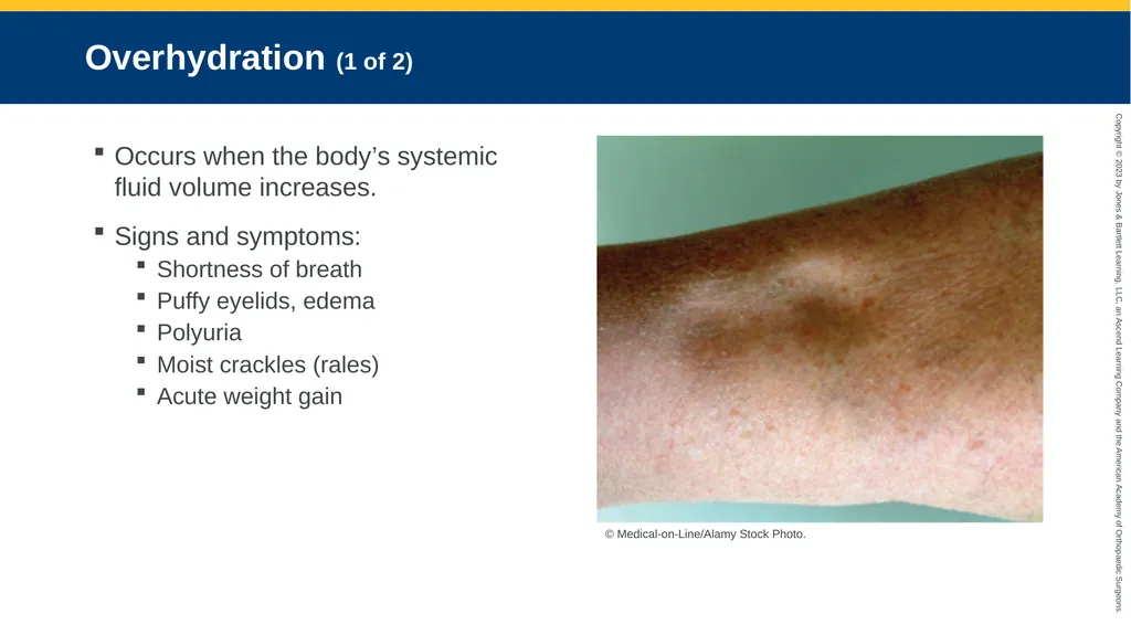 Medication Administration CHAPTER 14 Introduction - slide 20 of 185