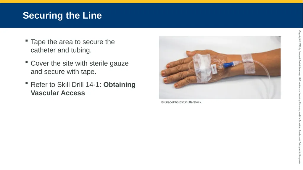 Medication Administration CHAPTER 14 Introduction - slide 52 of 185