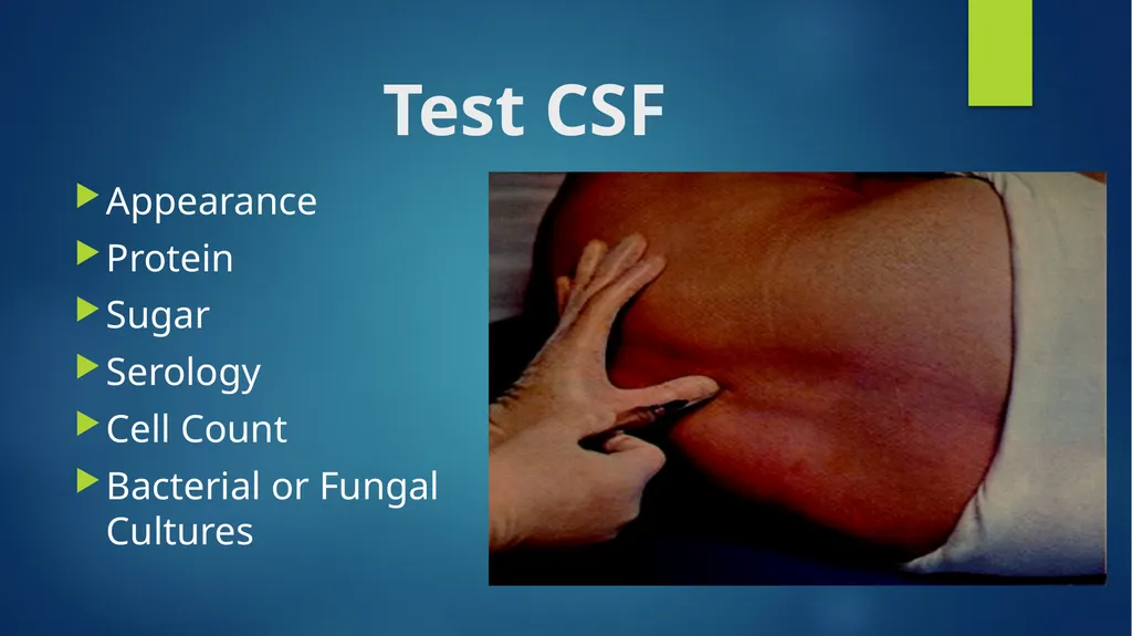 CSI 201 Skills Lab 2 Lumbar Puncture Daryl P. - slide 8 of 13