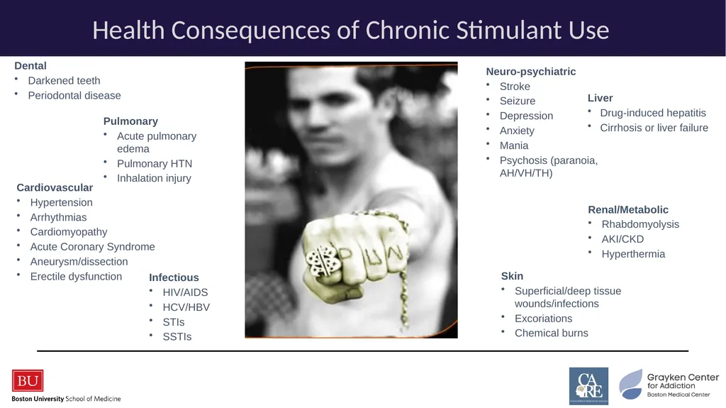 Stimulants: Cocaine & Methamphetamine CRIT/FIT/CFS - slide 18 of 39