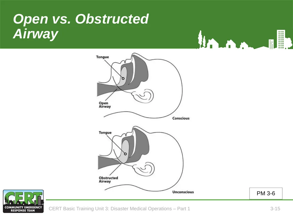 Unit 3: Disaster Medical Operations - Part 1 CERT - slide 16 of 51