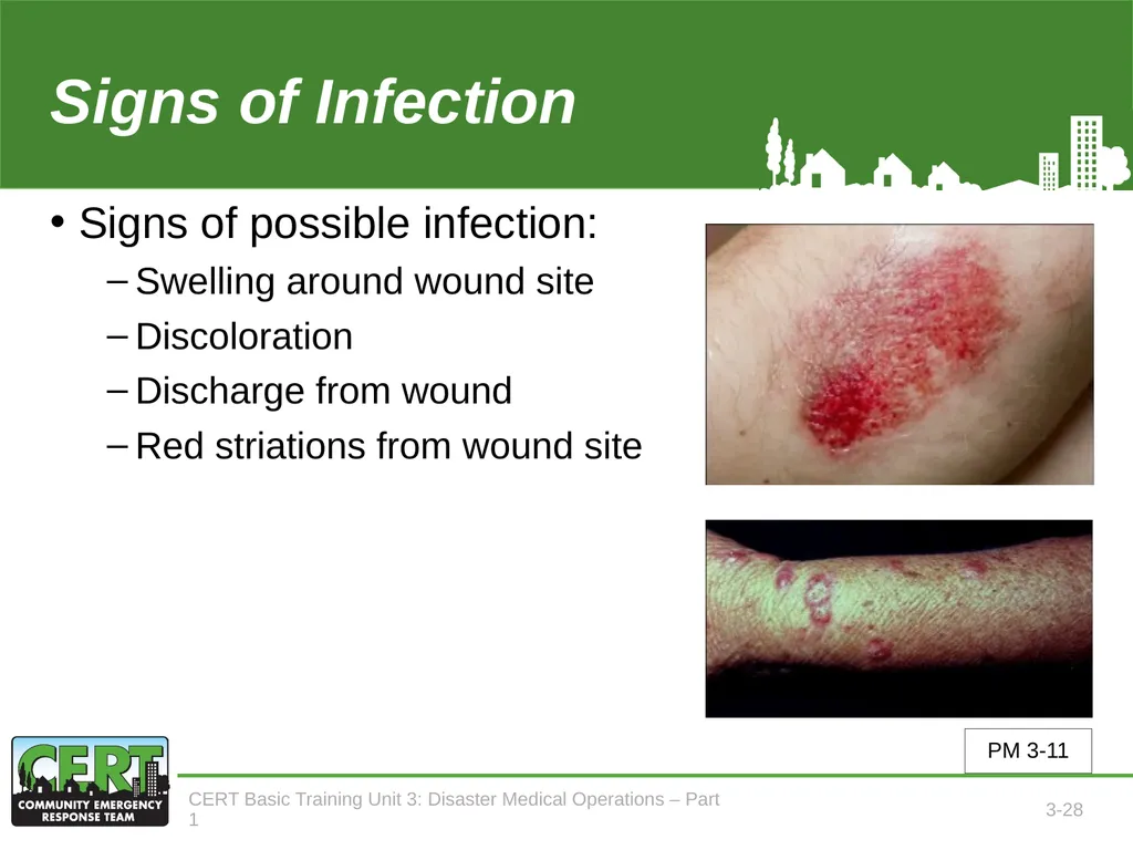 Unit 3: Disaster Medical Operations - Part 1 CERT - slide 29 of 51
