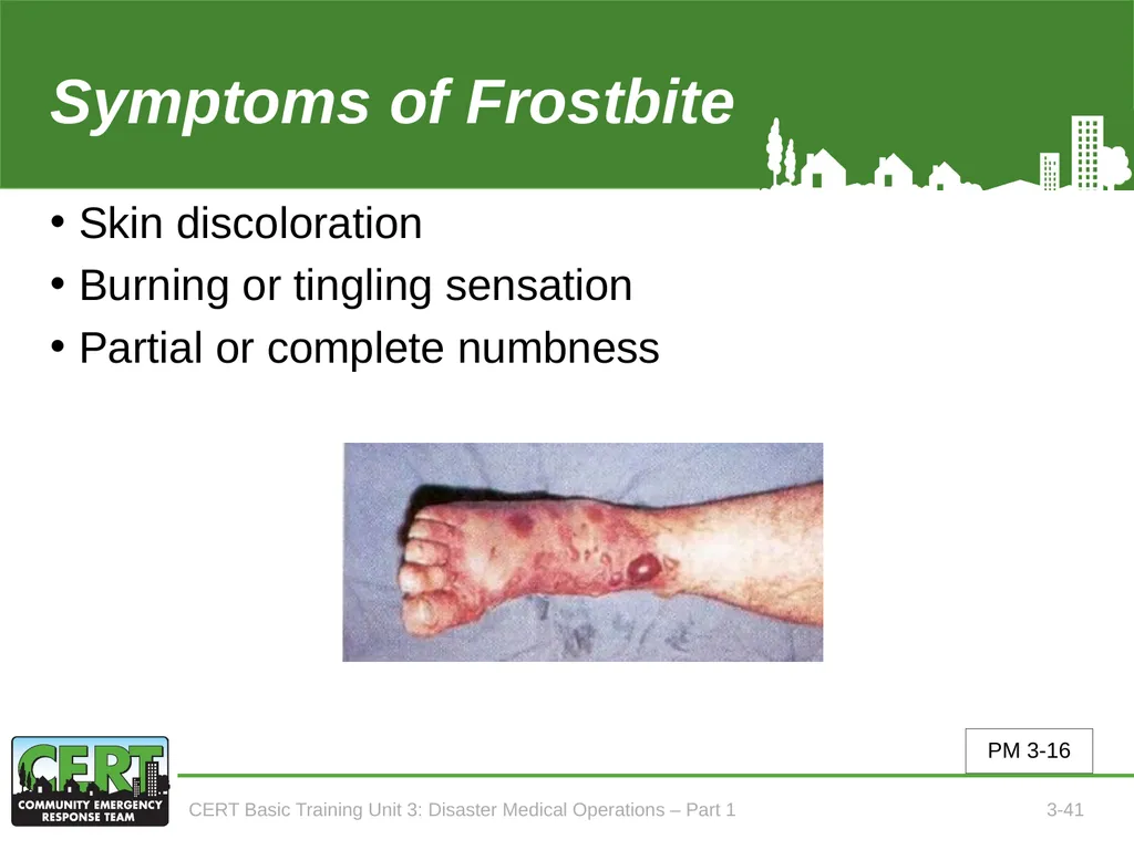 Unit 3: Disaster Medical Operations - Part 1 CERT - slide 42 of 51