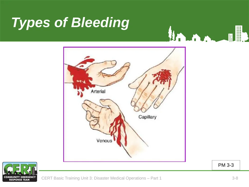 Unit 3: Disaster Medical Operations - Part 1 CERT - slide 9 of 51