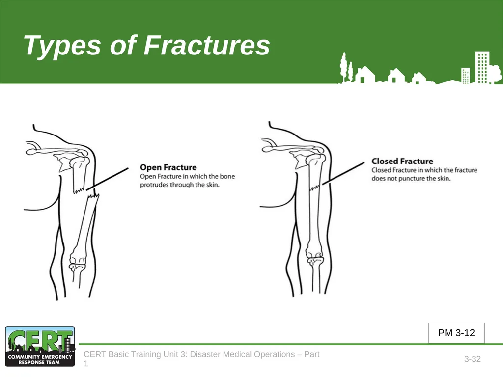 Unit 3: Disaster Medical Operations - Part 1 CERT - slide 33 of 51