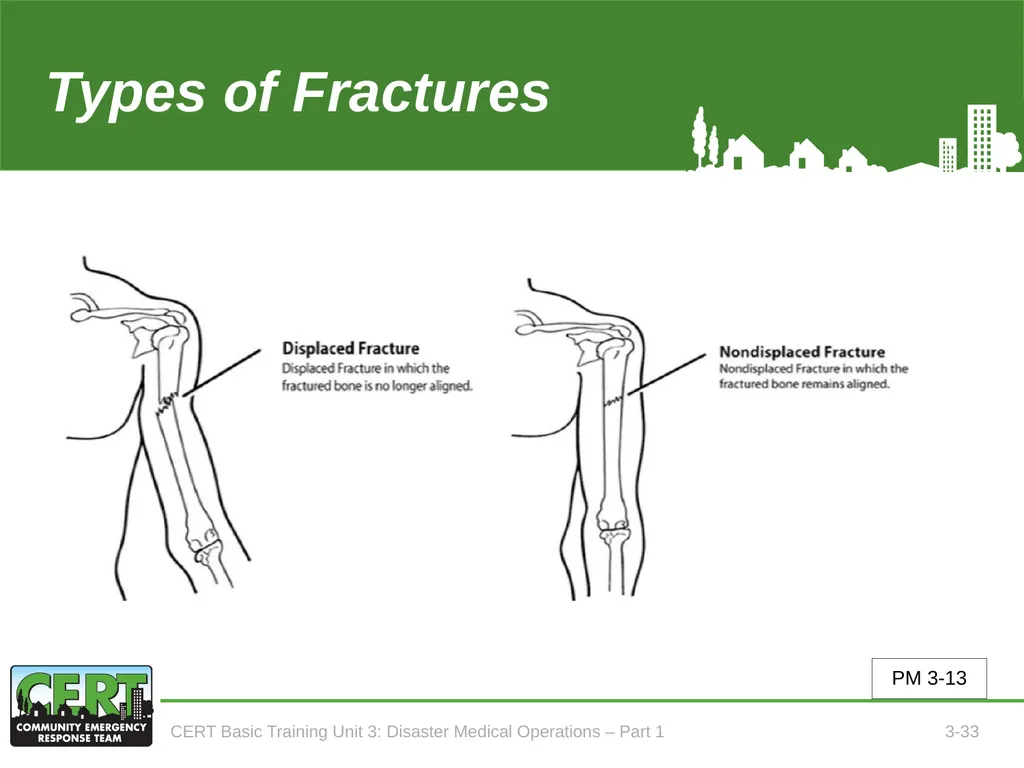 Unit 3: Disaster Medical Operations - Part 1 CERT - slide 34 of 51