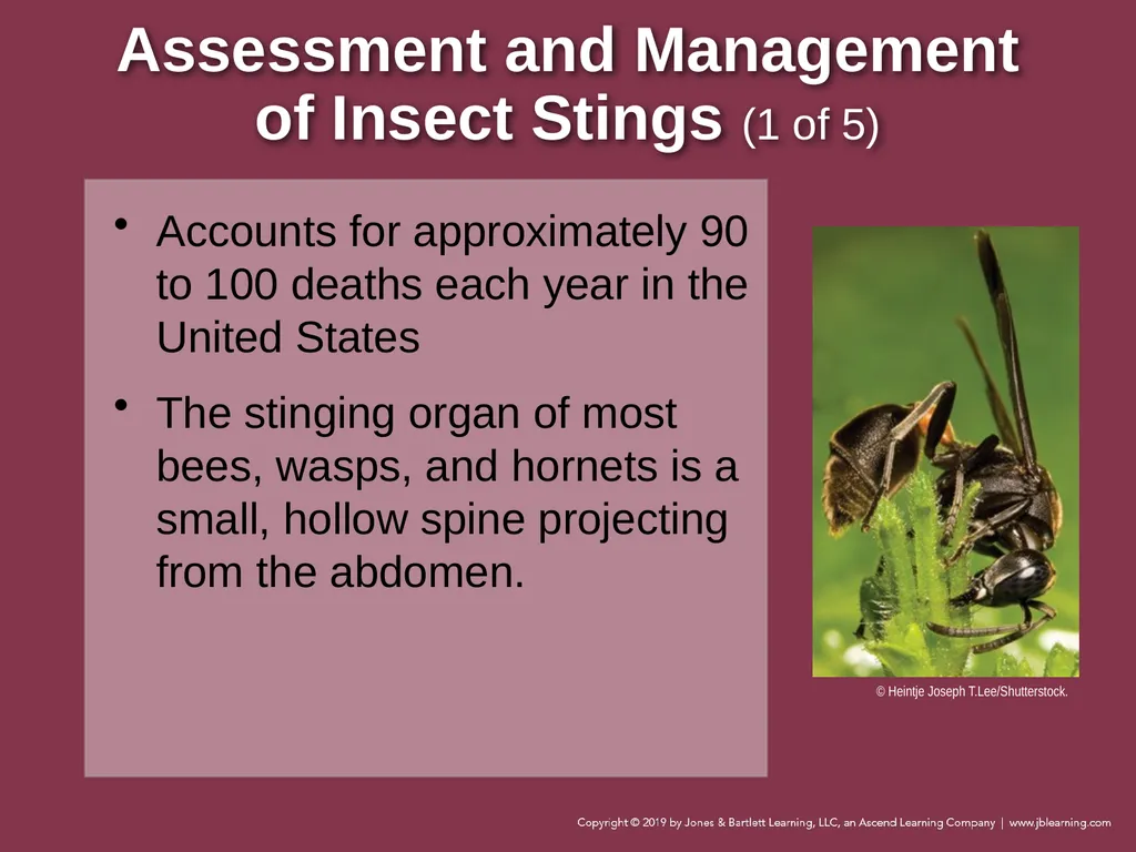 Focused Lecture Chapter 22 Immunologic Emergencies - slide 26 of 31