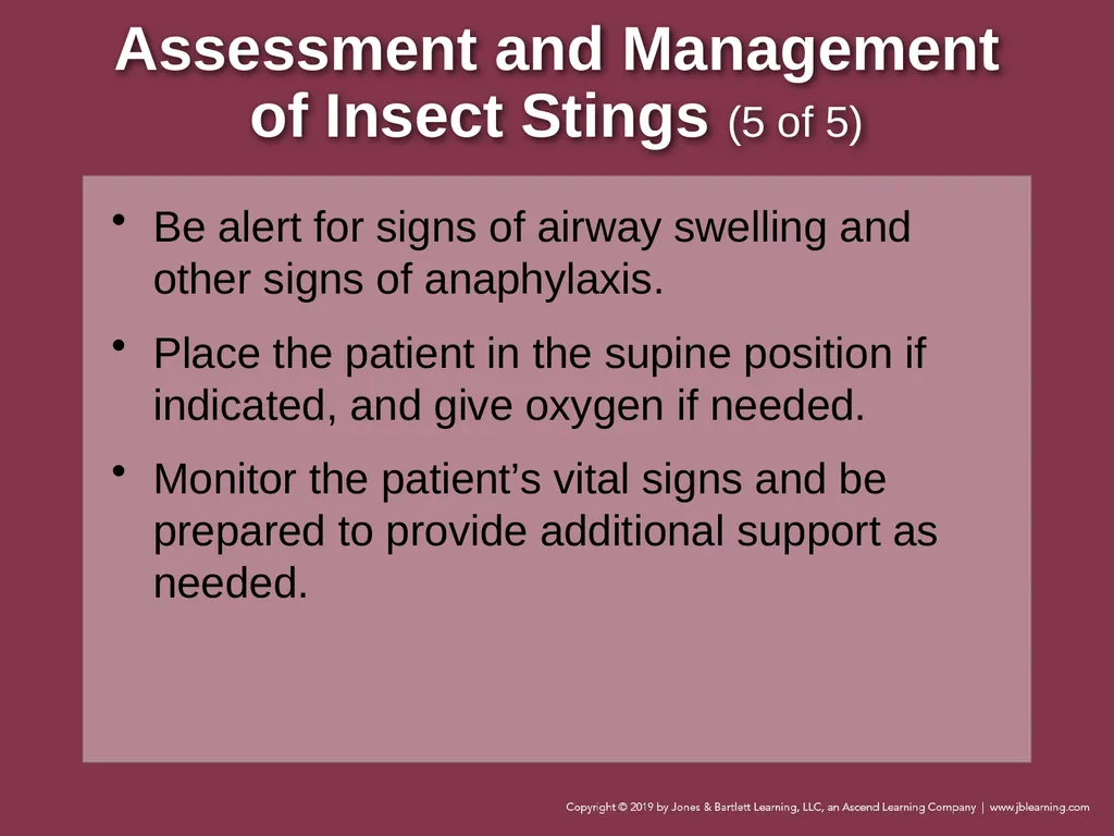 Focused Lecture Chapter 22 Immunologic Emergencies - slide 30 of 31
