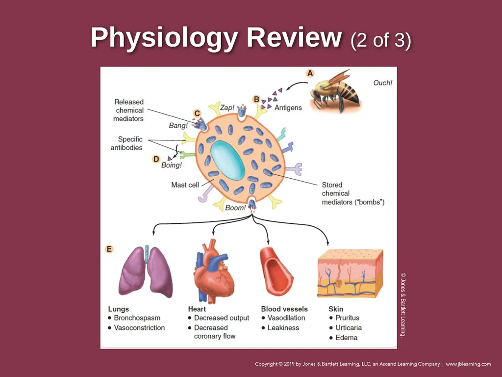Focused Lecture Chapter 22 Immunologic Emergencies - slide 7 of 31