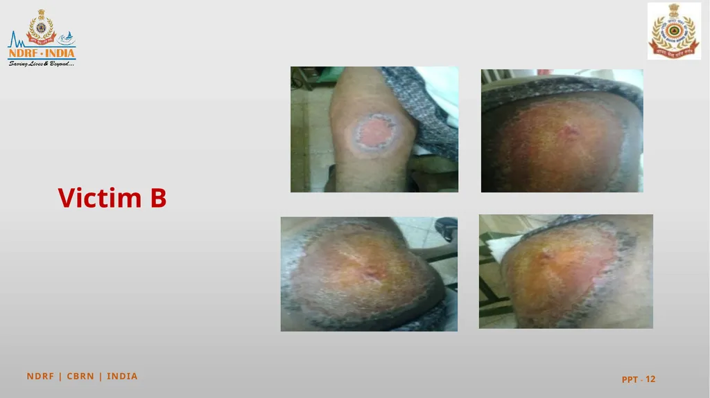 PEER | CSSR | INDIA PPT 2 - 1 Mayapuri - slide 12 of 37