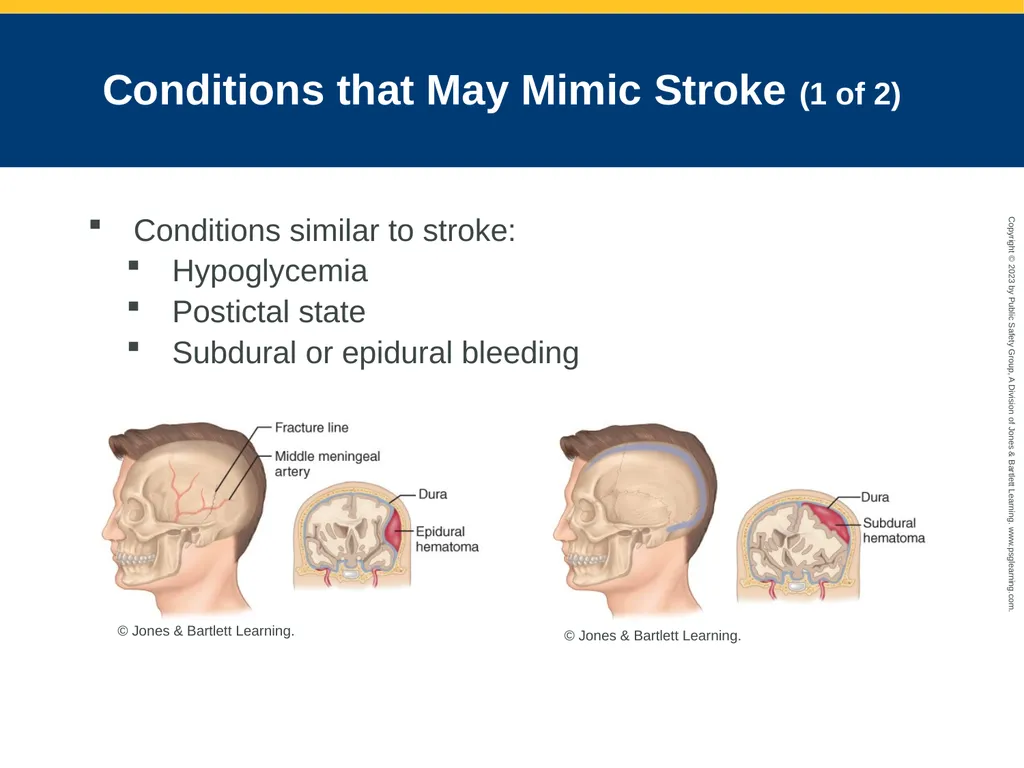 Neurologic Emergencies CHAPTER 19: Focused Lecture - slide 26 of 59