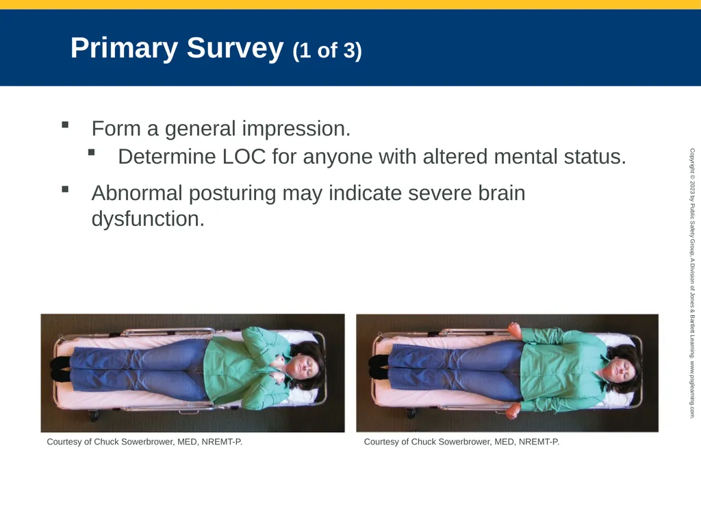 Neurologic Emergencies CHAPTER 19: Focused Lecture - slide 45 of 59