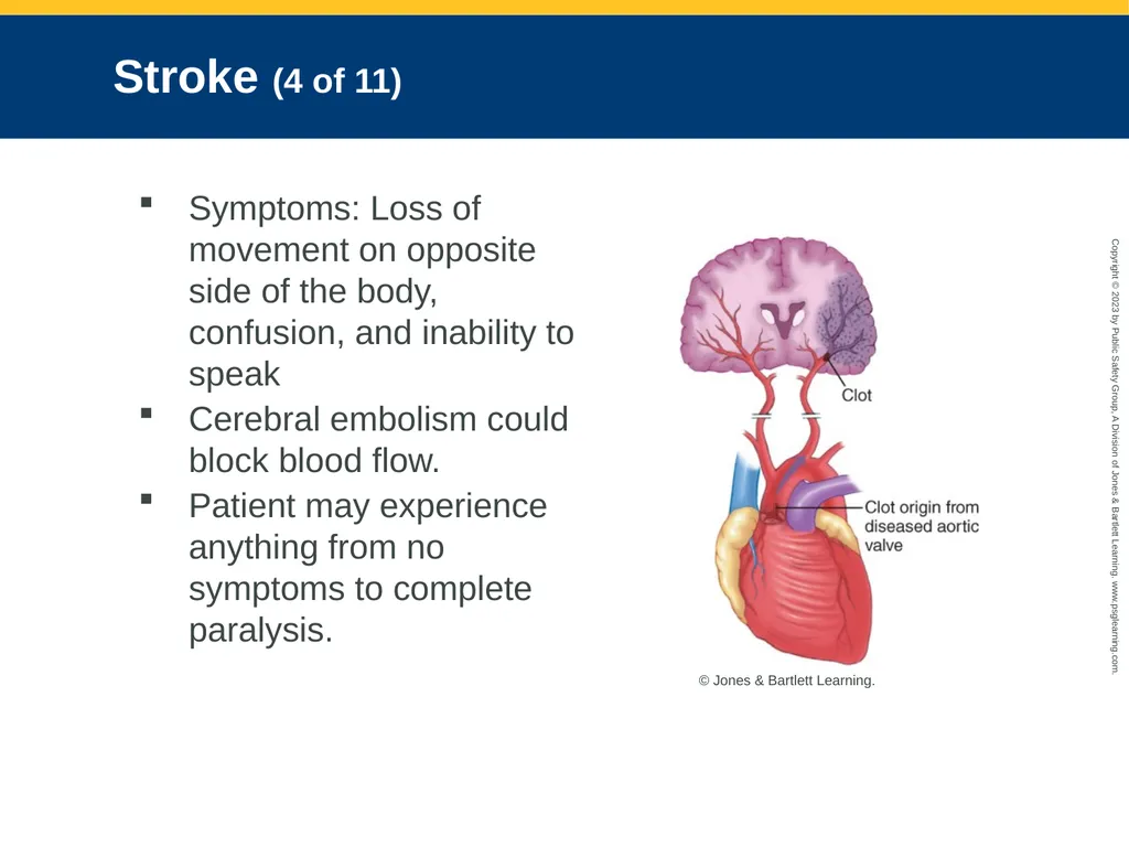 Neurologic Emergencies CHAPTER 19: Focused Lecture - slide 18 of 59