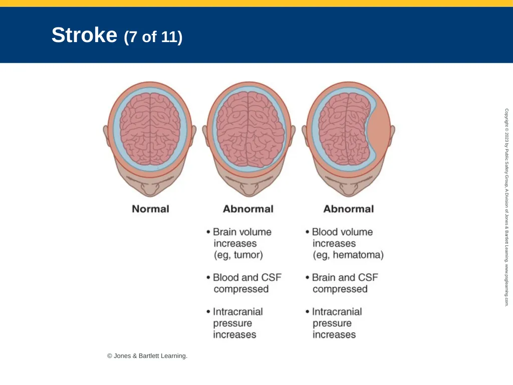 Neurologic Emergencies CHAPTER 19: Focused Lecture - slide 21 of 59