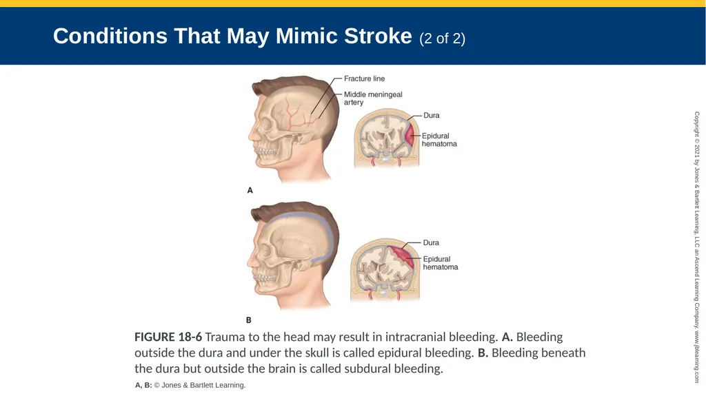 CHAPTER 18 Neurologic Emergencies National EMS - slide 35 of 103