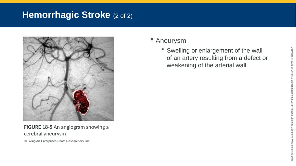 CHAPTER 18 Neurologic Emergencies National EMS - slide 25 of 103