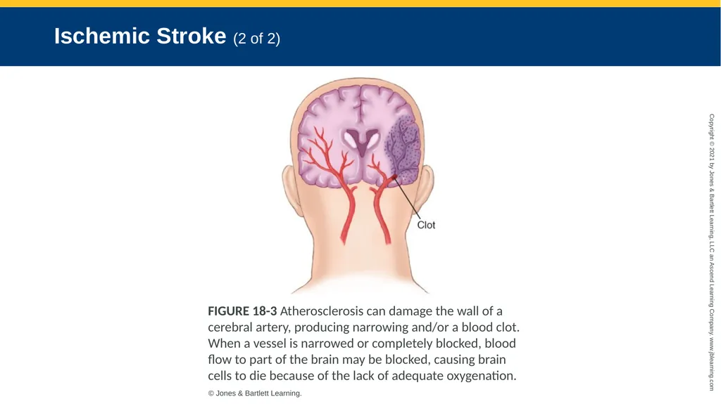 CHAPTER 18 Neurologic Emergencies National EMS - slide 23 of 103