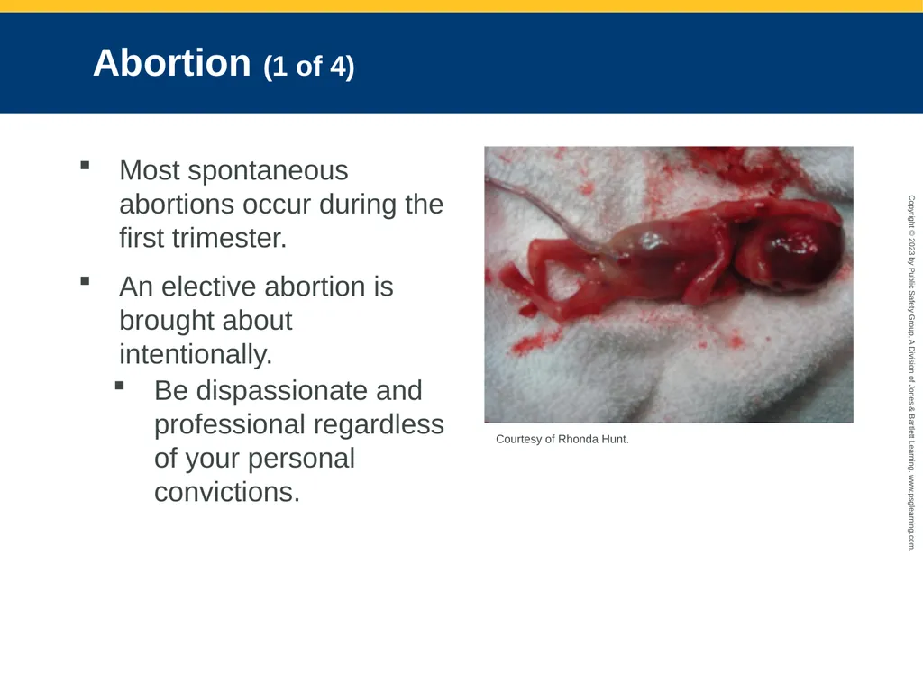Obstetrics and Neonatal Care CHAPTER 35: Focused - slide 22 of 126