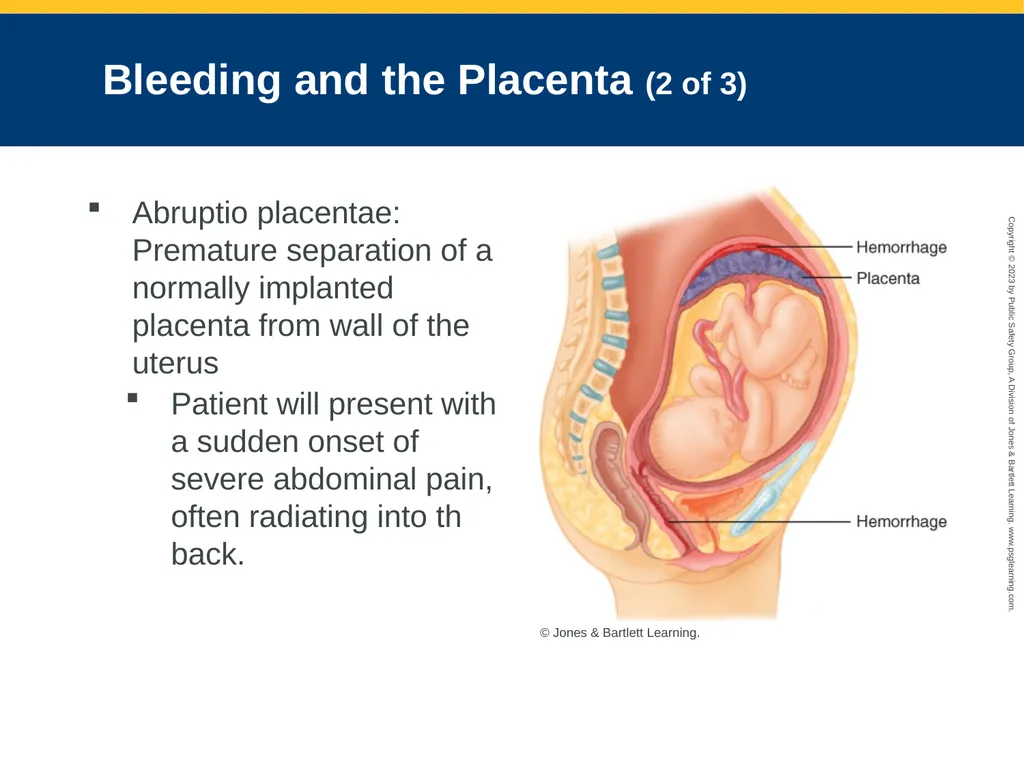 Obstetrics and Neonatal Care CHAPTER 35: Focused - slide 29 of 126