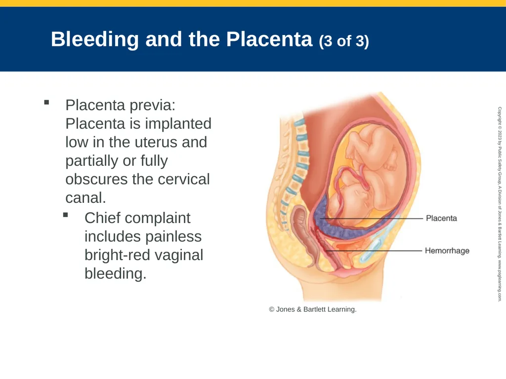 Obstetrics and Neonatal Care CHAPTER 35: Focused - slide 30 of 126