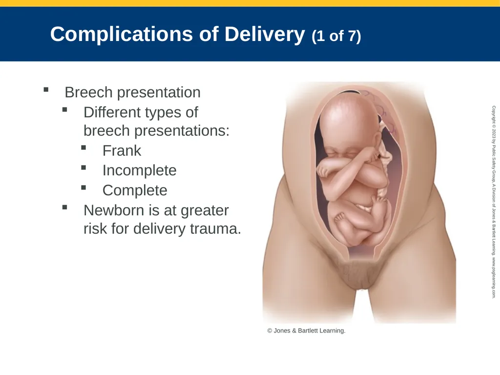 Obstetrics and Neonatal Care CHAPTER 35: Focused - slide 93 of 126