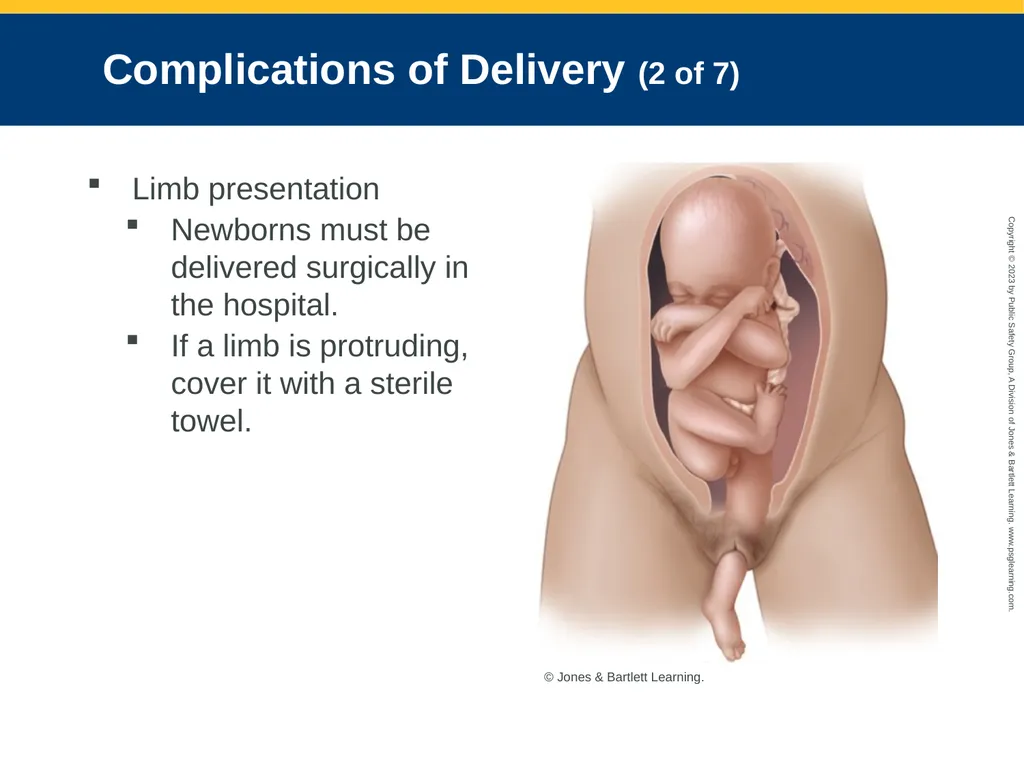 Obstetrics and Neonatal Care CHAPTER 35: Focused - slide 94 of 126
