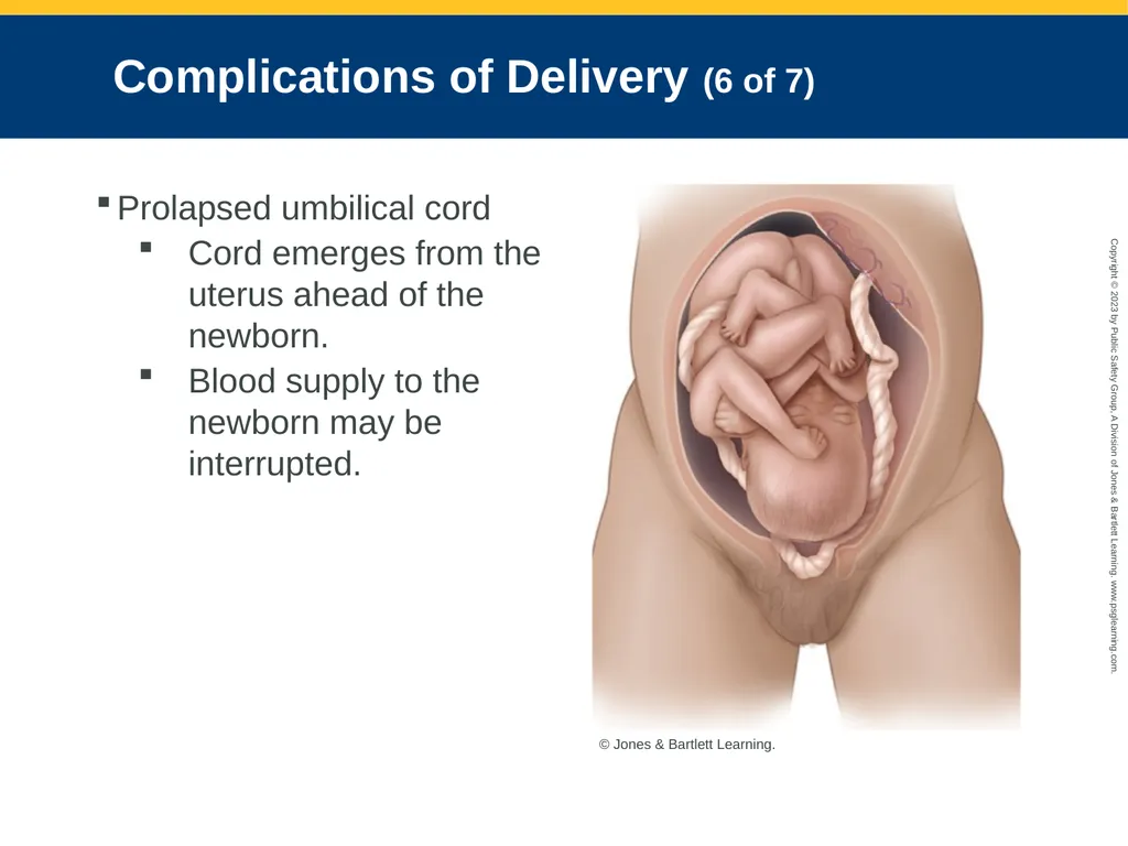 Obstetrics and Neonatal Care CHAPTER 35: Focused - slide 98 of 126