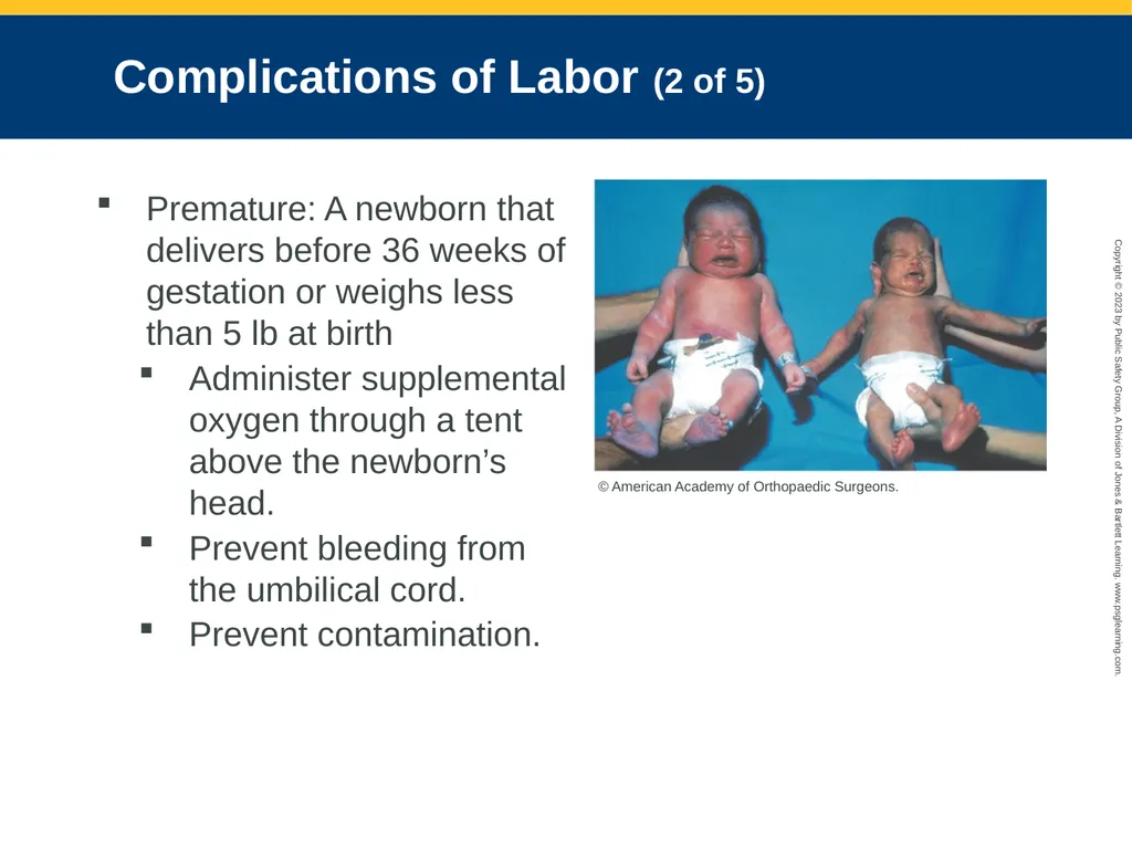 Obstetrics and Neonatal Care CHAPTER 35: Focused - slide 83 of 126